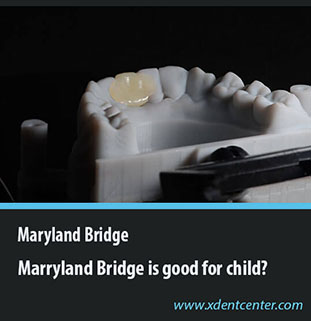 MARYLAND BRIDGE IS GOOD FOR CHILDREN?
