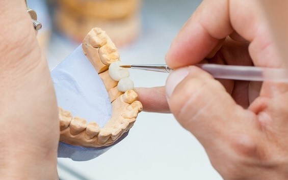 WHAT DO YOU KNOW ABOUT THE DENTAL TECHNICIAN?