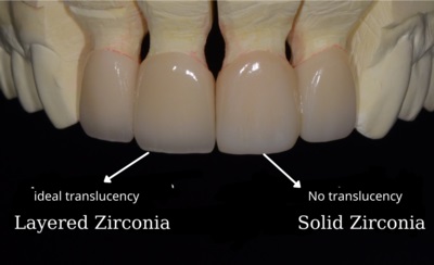 Layered and Solid Zirconia