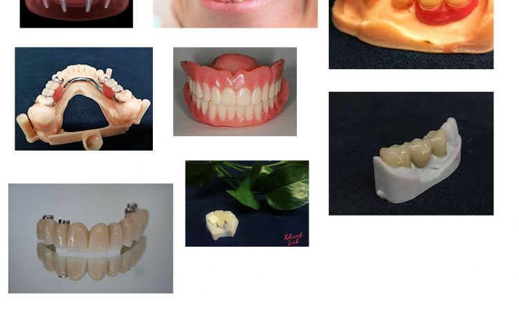 8 methods of dental treatment