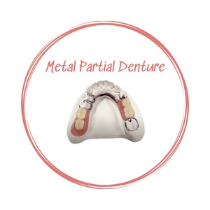 Metal Partial Denture